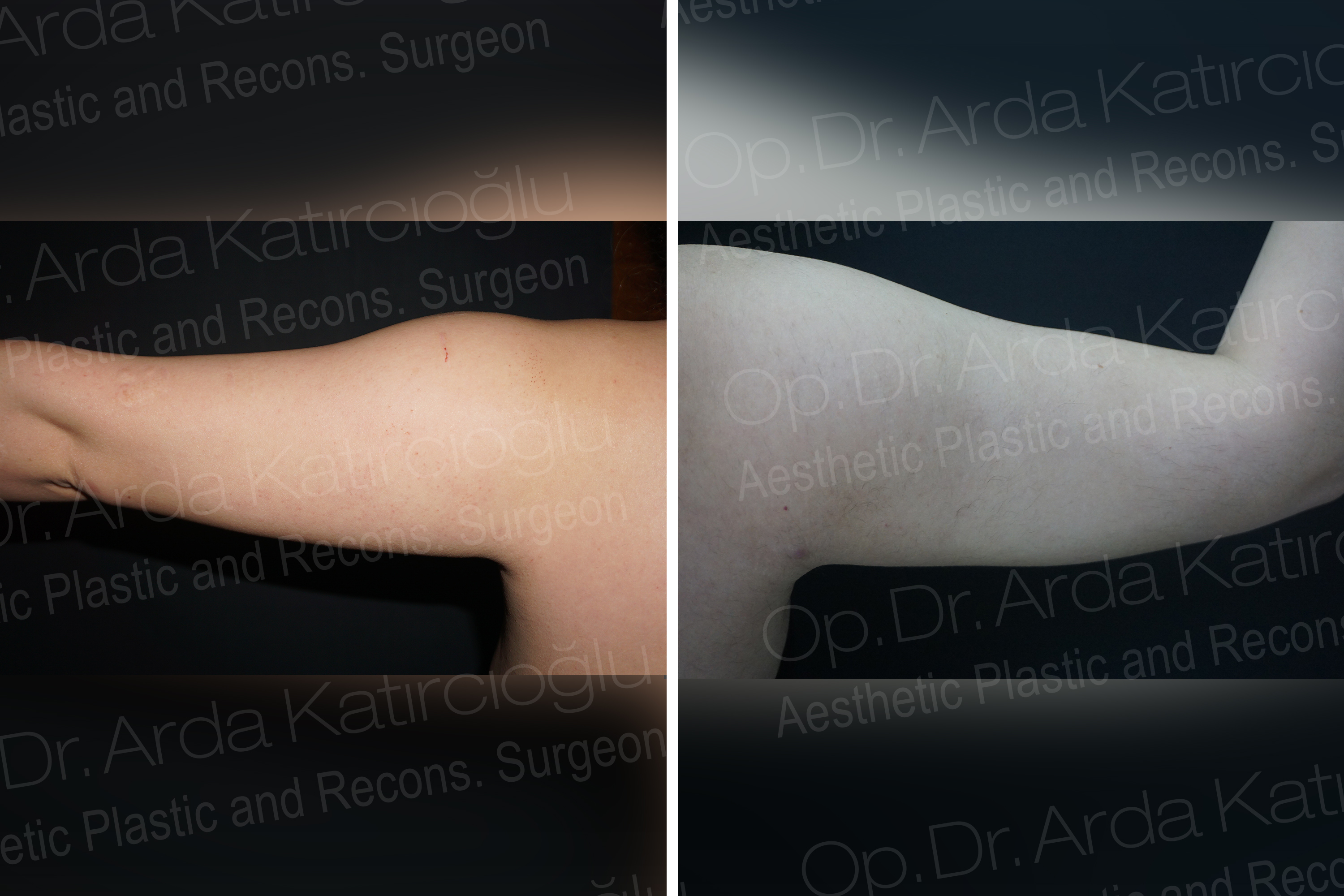 Miaplast Esthetic Surgery Op. Dr. Arda Katırcıoğlu
